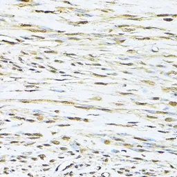 Anti-Ku70 antibody used in IHC (Paraffin sections) (IHC-P). GTX64359