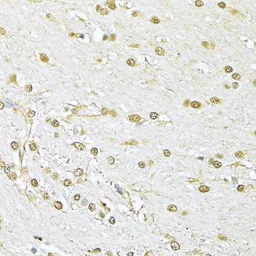 Anti-Ku70 antibody used in IHC (Paraffin sections) (IHC-P). GTX64359