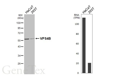 Anti-VPS4B antibody [HL4340] used in Western Blot (WB). GTX643590