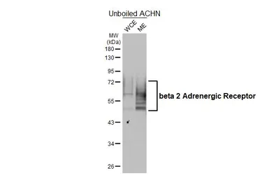 Anti-beta 2 Adrenergic Receptor antibody [HL4346] used in Western Blot (WB). GTX643596