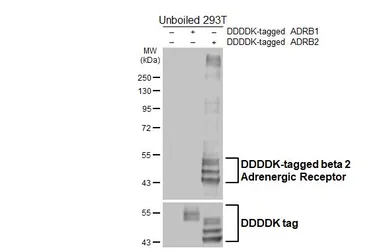 Anti-beta 2 Adrenergic Receptor antibody [HL4346] used in Western Blot (WB). GTX643596