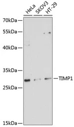 Anti-TIMP1 antibody used in Western Blot (WB). GTX64360
