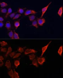 Anti-TIMP1 antibody used in Immunocytochemistry/ Immunofluorescence (ICC/IF). GTX64360