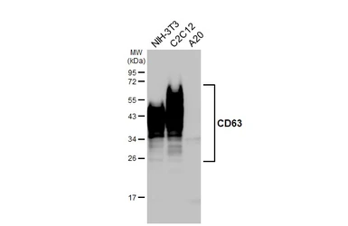 Anti-CD63 antibody [HL4361] used in Western Blot (WB). GTX643611