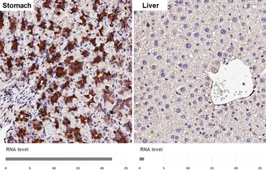 Anti-CD63 antibody [HL4361] used in IHC (Paraffin sections) (IHC-P). GTX643611