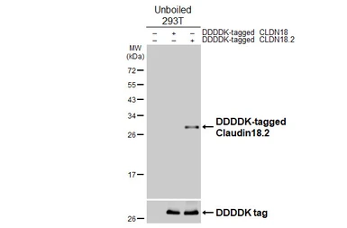 Anti-Claudin 18.2 antibody [GT206] used in Western Blot (WB). GTX643617