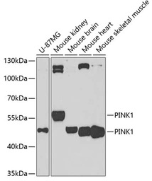Anti-PINK1 antibody used in Western Blot (WB). GTX64362