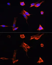 Anti-PINK1 antibody used in Immunocytochemistry/ Immunofluorescence (ICC/IF). GTX64362