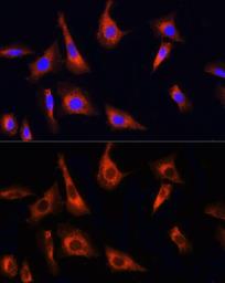 Anti-PINK1 antibody used in Immunocytochemistry/ Immunofluorescence (ICC/IF). GTX64362