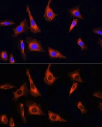 Anti-PINK1 antibody used in Immunocytochemistry/ Immunofluorescence (ICC/IF). GTX64362