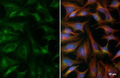 Anti-DNA polymerase gamma antibody [HL4365] used in Immunocytochemistry/ Immunofluorescence (ICC/IF). GTX643622