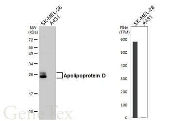 Anti-Apolipoprotein D antibody [HL4368] used in Western Blot (WB). GTX643625