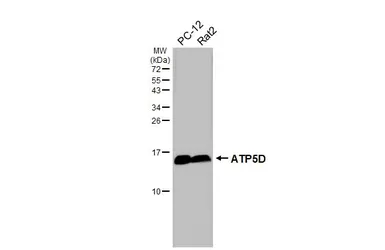 Anti-ATP5D antibody [HL4372] used in Western Blot (WB). GTX643629
