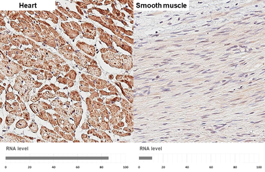 Anti-ATP5D antibody [HL4372] used in IHC (Paraffin sections) (IHC-P). GTX643629