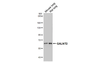 Anti-GALNT2 antibody [HL4377] used in Western Blot (WB). GTX643634