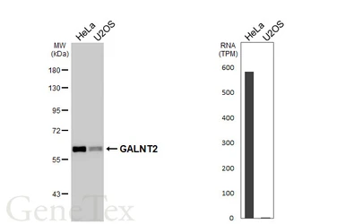 Anti-GALNT2 antibody [HL4377] used in Western Blot (WB). GTX643634