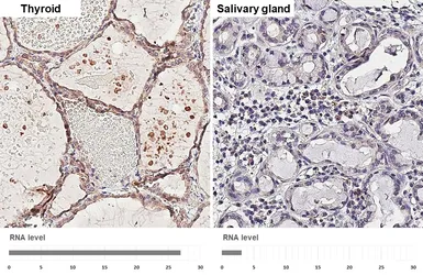 Anti-ADAM10 antibody [HL4378] used in IHC (Paraffin sections) (IHC-P). GTX643635
