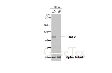 Anti-LOXL2 antibody [HL4379] used in Western Blot (WB). GTX643636