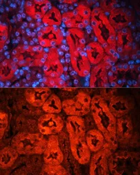 Anti-Lipocalin-2 antibody used in IHC (Paraffin sections) (IHC-P). GTX64364