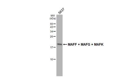 Anti-MAFF + MAFG + MAFK antibody [HL4383] used in Western Blot (WB). GTX643640