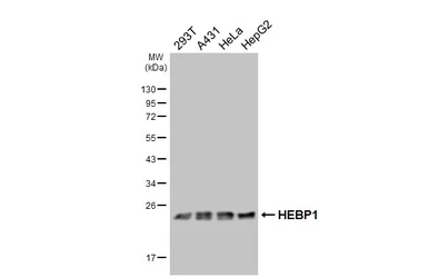 Anti-HEBP1 antibody [HL4384] used in Western Blot (WB). GTX643641