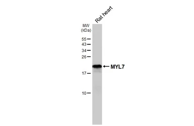 Anti-MYL7 antibody [HL4385] used in Western Blot (WB). GTX643642