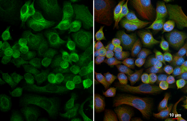 Anti-Activin B antibody [HL4390] used in Immunocytochemistry/ Immunofluorescence (ICC/IF). GTX643647