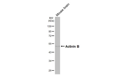 Anti-Activin B antibody [HL4390] used in Western Blot (WB). GTX643647
