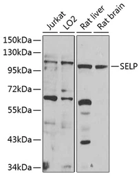 Anti-CD62P antibody used in Western Blot (WB). GTX64365