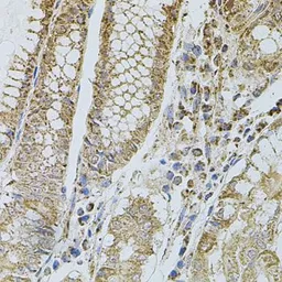 Anti-CD62P antibody used in IHC (Paraffin sections) (IHC-P). GTX64365