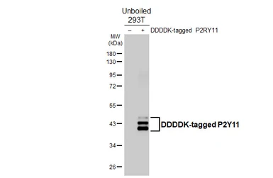 Anti-P2Y11 antibody [HL4400] used in Western Blot (WB). GTX643657