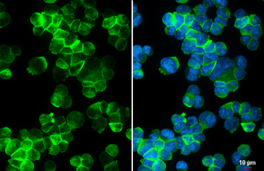 Anti-P2Y11 antibody [HL4400] used in Immunocytochemistry/ Immunofluorescence (ICC/IF). GTX643657