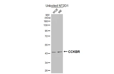 Anti-CCKBR antibody [HL4404] used in Western Blot (WB). GTX643661