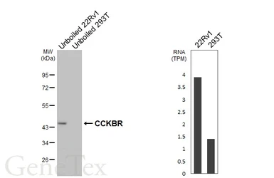 Anti-CCKBR antibody [HL4404] used in Western Blot (WB). GTX643661