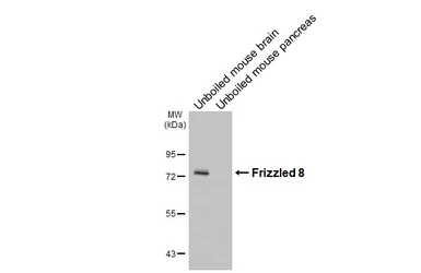 Anti-Frizzled 8 antibody [HL4405] used in Western Blot (WB). GTX643662