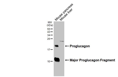 Anti-GLP1 antibody [HL4412] used in Western Blot (WB). GTX643669