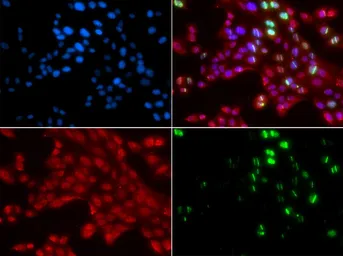 Anti-53BP1 antibody used in Immunocytochemistry/ Immunofluorescence (ICC/IF). GTX64370