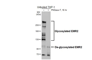 Anti-EMR2 antibody [HL4418] used in Western Blot (WB). GTX643707