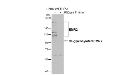 Anti-EMR2 antibody [HL4420] used in Western Blot (WB). GTX643709