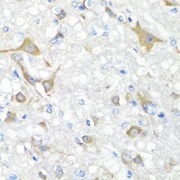 Anti-IL22 antibody used in IHC (Paraffin sections) (IHC-P). GTX64371