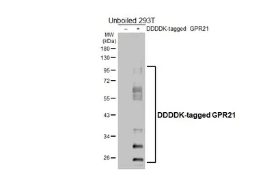 Anti-GPR21 antibody [HL4426] used in Western Blot (WB). GTX643715