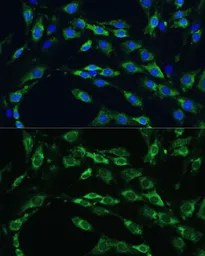 Anti-Apolipoprotein B antibody used in Immunocytochemistry/ Immunofluorescence (ICC/IF). GTX64377
