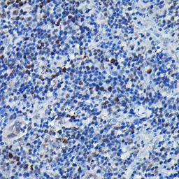 Anti-C/EBP beta antibody used in IHC (Paraffin sections) (IHC-P). GTX64382
