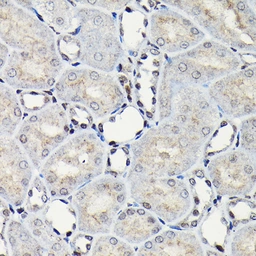 Anti-C/EBP beta antibody used in IHC (Paraffin sections) (IHC-P). GTX64382