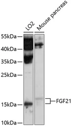 Anti-FGF21 antibody used in Western Blot (WB). GTX64384