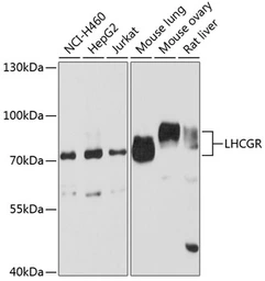 Anti-LHR antibody used in Western Blot (WB). GTX64387