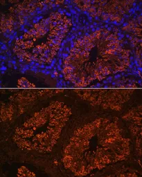Anti-LHR antibody used in IHC (Paraffin sections) (IHC-P). GTX64387