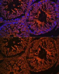 Anti-LHR antibody used in IHC (Paraffin sections) (IHC-P). GTX64387