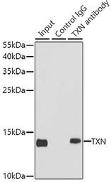 Anti-Thioredoxin antibody used in Immunoprecipitation (IP). GTX64390