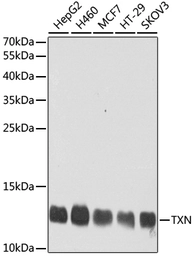 Anti-Thioredoxin antibody used in Western Blot (WB). GTX64390